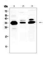 IL-1 beta Polyclonal Antibody