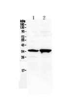 SIX3 Polyclonal Antibody