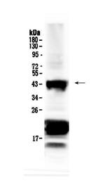 CHX10 Polyclonal Antibody