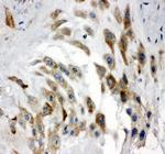 Noggin Polyclonal Antibody