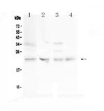 TIMP1 Polyclonal Antibody