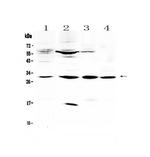 VEGFB Polyclonal Antibody