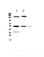 GCK Polyclonal Antibody