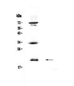IL17B Polyclonal Antibody