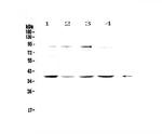 OGG1 Polyclonal Antibody
