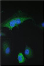 14-3-3 sigma Polyclonal Antibody