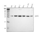 14-3-3 sigma Antibody in Western Blot (WB)