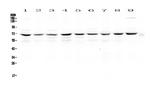 cIAP1 Antibody in Western Blot (WB)