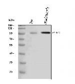 DYRK1A Antibody in Western Blot (WB)