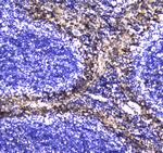 S100A10 Antibody in Immunohistochemistry (Paraffin) (IHC (P))