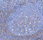 S100A10 Antibody in Immunohistochemistry (Paraffin) (IHC (P))