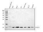 S100A10 Antibody in Western Blot (WB)