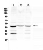 SFTPB Polyclonal Antibody