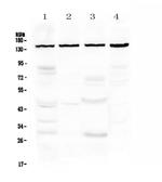 TRPC4 Antibody in Western Blot (WB)