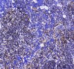 SHIP1 Polyclonal Antibody