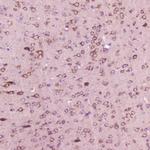 Calcitonin Polyclonal Antibody