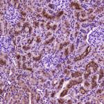 PDGFRB Antibody in Immunohistochemistry (Paraffin) (IHC (P))