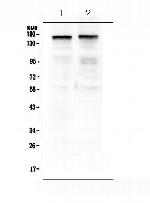 Thrombospondin 2 Polyclonal Antibody