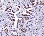 TPR Polyclonal Antibody