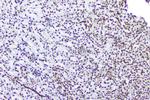 TPR Antibody in Immunohistochemistry (Paraffin) (IHC (P))