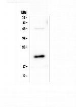AES Antibody in Western Blot (WB)