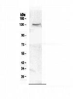 CACNA2D2 Polyclonal Antibody