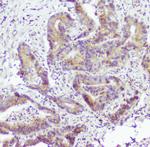 Caspase 2 Polyclonal Antibody