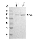 P-cadherin Antibody in Western Blot (WB)