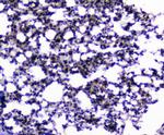 CIC Antibody in Immunohistochemistry (Paraffin) (IHC (P))