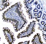 CIC Antibody in Immunohistochemistry (Paraffin) (IHC (P))