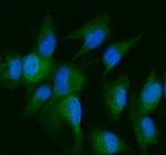 DDR2 Polyclonal Antibody