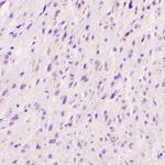 ELAVL2 Polyclonal Antibody