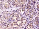 EML4 Antibody in Immunohistochemistry (Paraffin) (IHC (P))