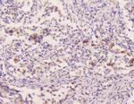 EML4 Antibody in Immunohistochemistry (Paraffin) (IHC (P))
