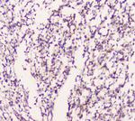 EML4 Antibody in Immunohistochemistry (Paraffin) (IHC (P))