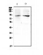 XPB Polyclonal Antibody