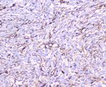 FCGR2A Polyclonal Antibody