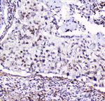 HMGN2 Antibody in Immunohistochemistry (Paraffin) (IHC (P))