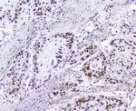 HMGN2 Polyclonal Antibody
