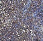 IFN gamma Polyclonal Antibody