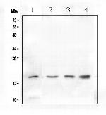IL-10 Polyclonal Antibody