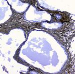 LUM Polyclonal Antibody