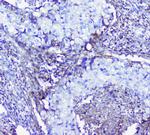 LUM Antibody in Immunohistochemistry (Paraffin) (IHC (P))