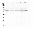 LUM Antibody in Western Blot (WB)