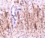 MEF2C Polyclonal Antibody