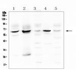 METTL3 Polyclonal Antibody