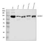 MIB1 Polyclonal Antibody