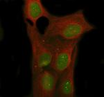 NOVA1 Polyclonal Antibody