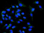 NOX5 Polyclonal Antibody