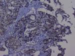 NRF1 Polyclonal Antibody